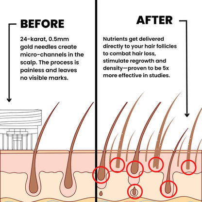 AlphaInfuse™ Hair Regrowth System